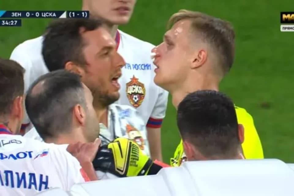 Нұрәлі Әліп ЦСКА қақпашысының мұрнын сындырды
